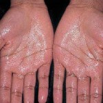 Top 10 Pinoy Health Myths You Thought Were True